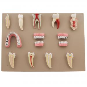 Image of Dental Disease Set of 14