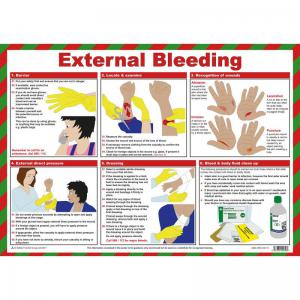 Safety First Aid First Aid for External Bleeding Poster, A2 Laminated