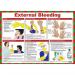 First Aid for External Bleeding Poster, A2 (Laminated) A609