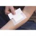 HypaCover Adhesive Dressing LG D7138