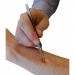 Tick Remover Q2485